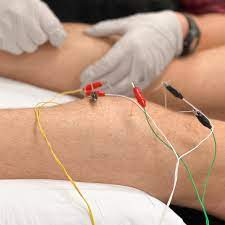 How Dry Needling Complements Physical Therapy: Enhancing Rehabilitation